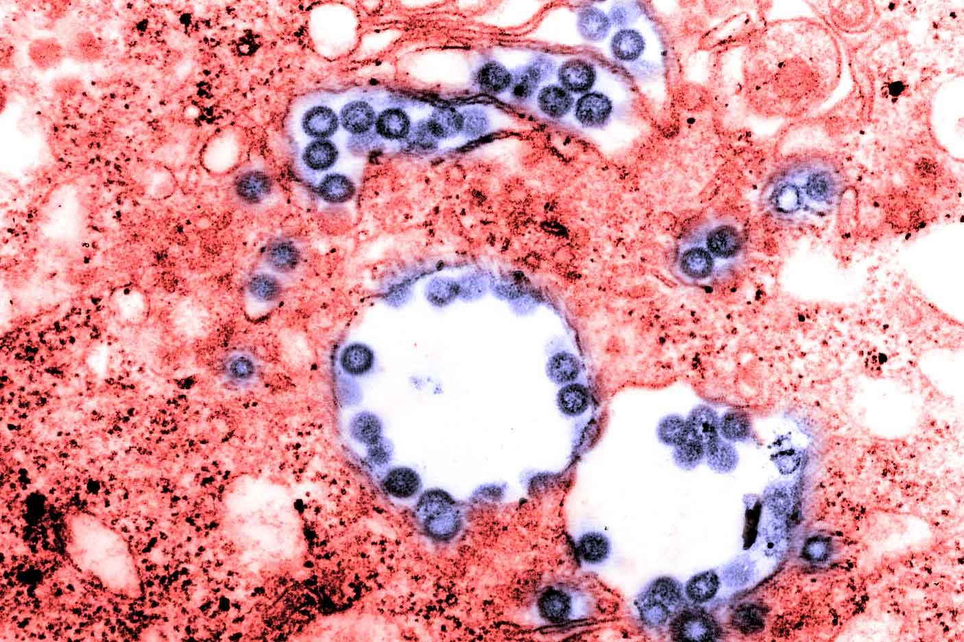 False coloured electron micrograph of Rift Valley fever virus