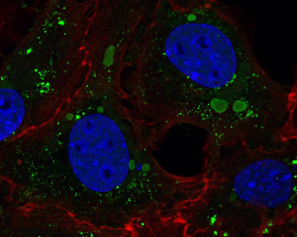 Fluorescent bioimaging image of EHDV