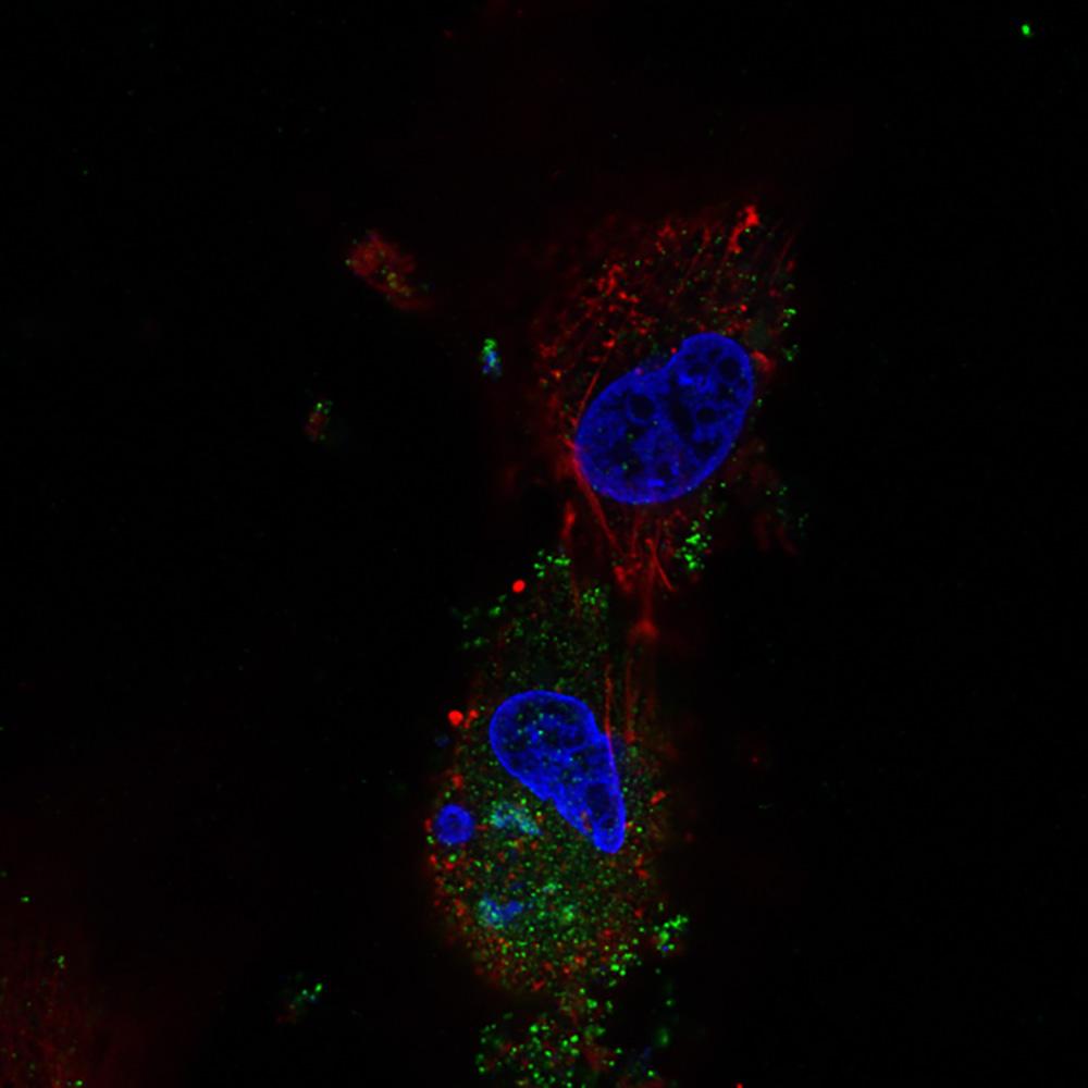 Fluorescent bioimaging image of goatpox