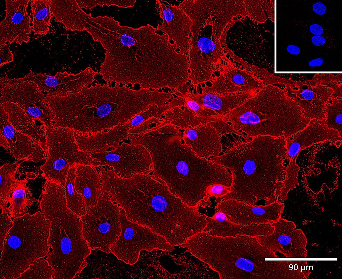 Microscopy image. Cells are red