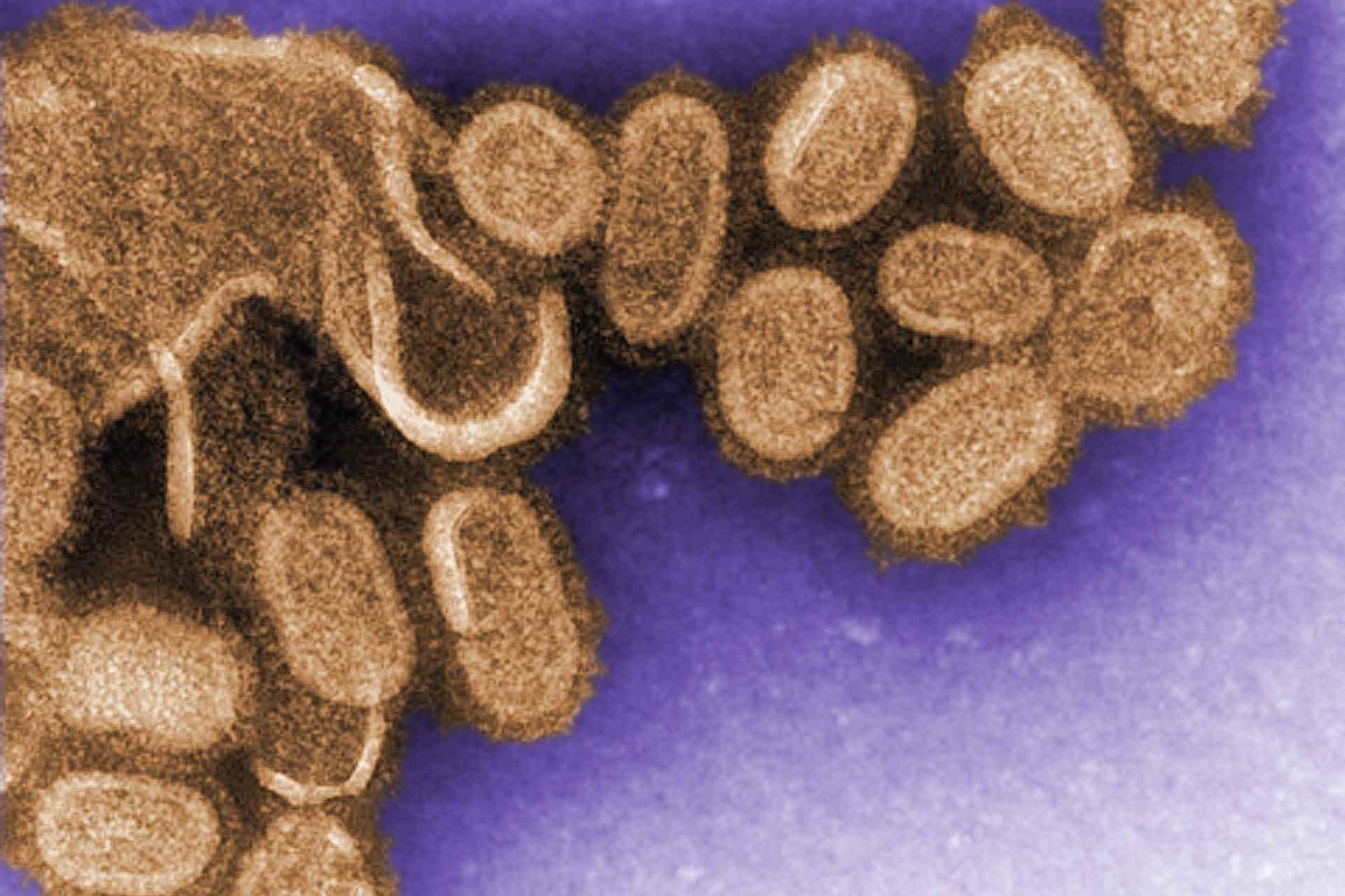 influenza virus coloured orange and purple