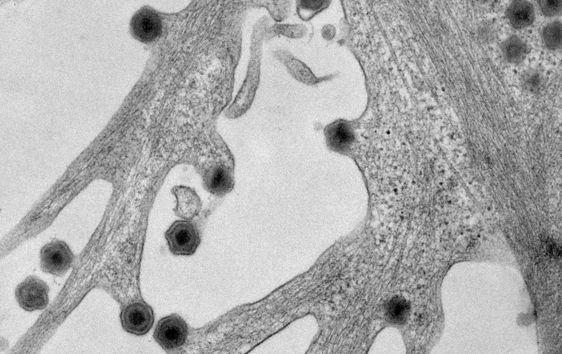 TEM of ASFV infected cells