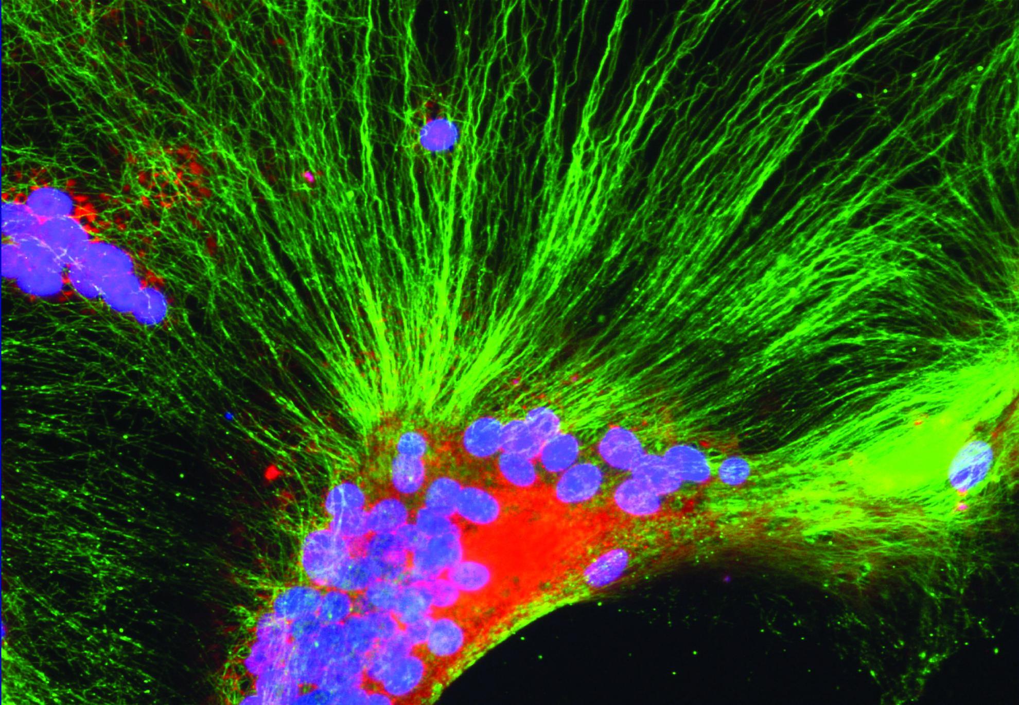 Cell Infected with PPRV Under the Microscope