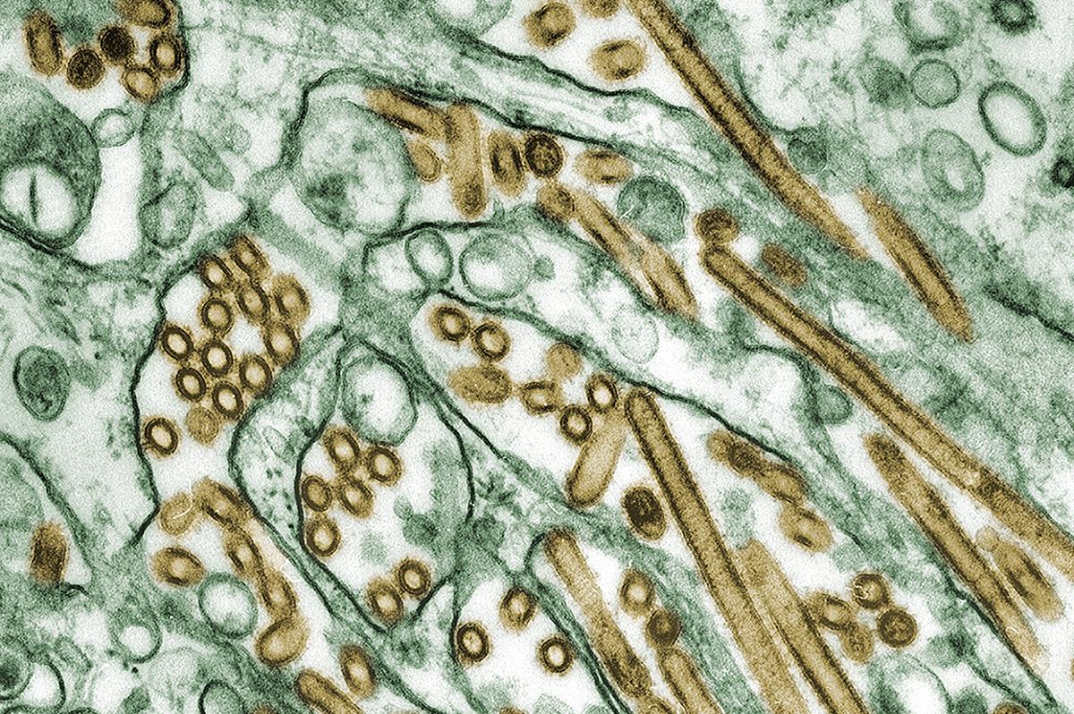 Influenza A H5N1 under the microscope