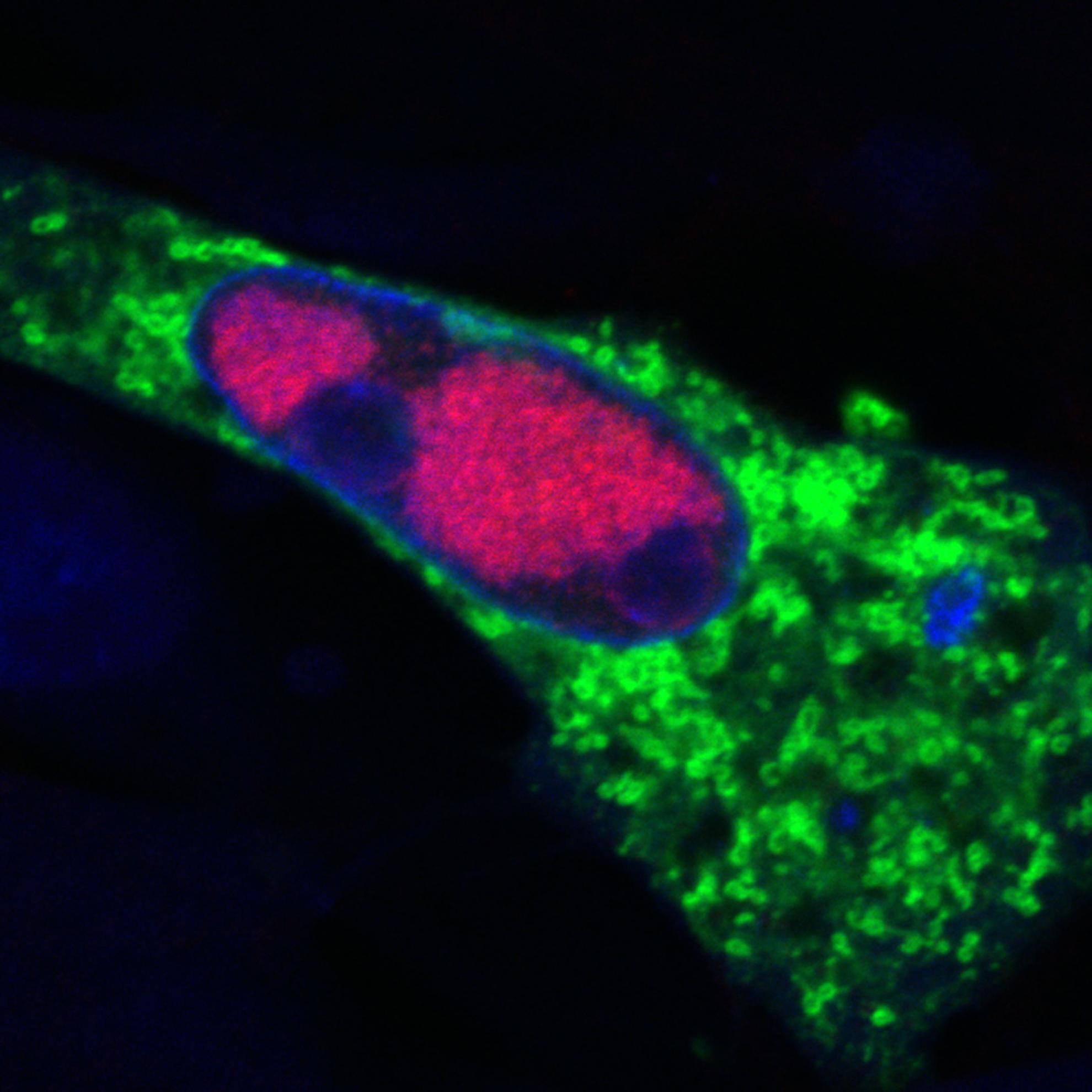 Image of a cell infected with Mareks disease