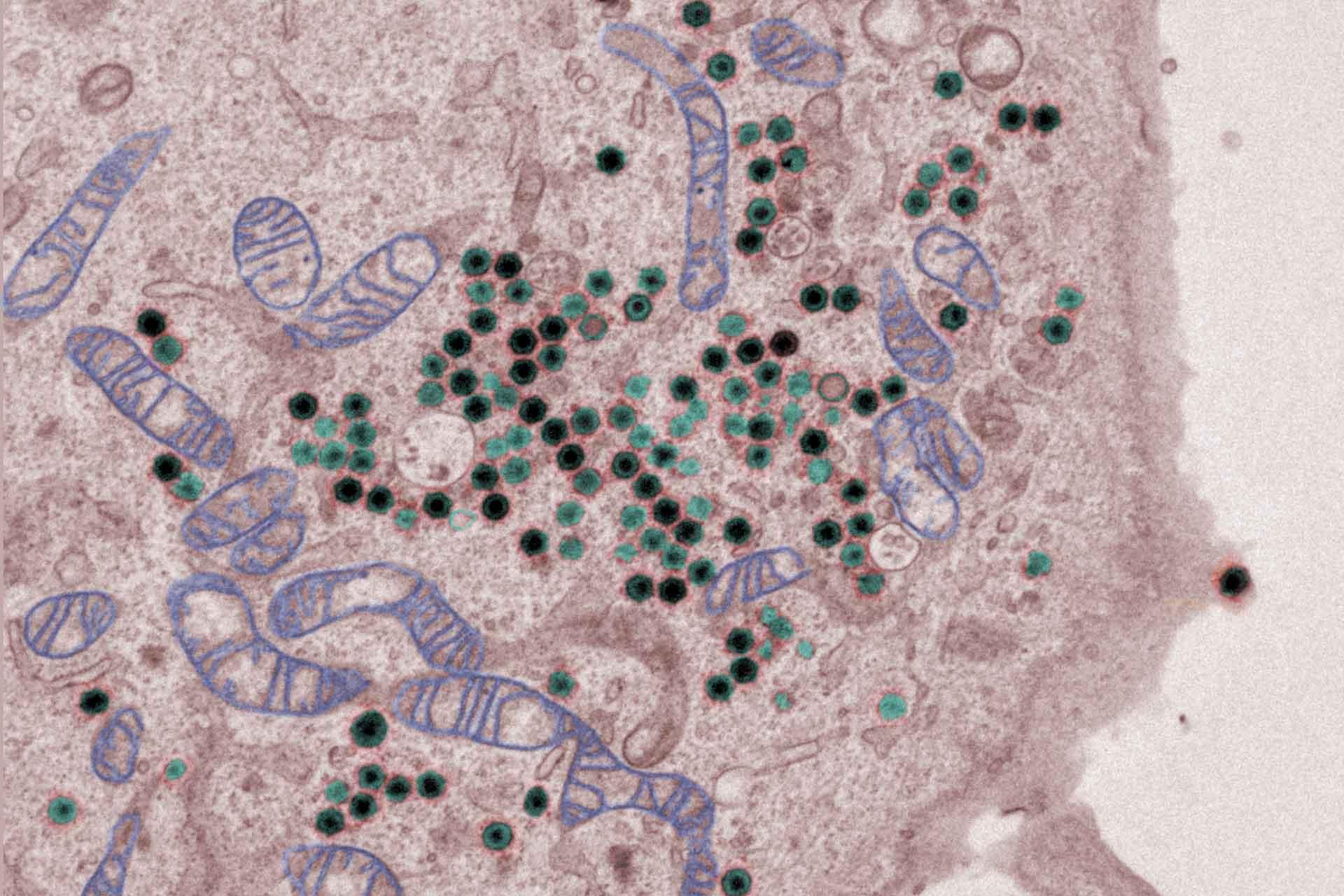 A cell infected by African swine fever virus