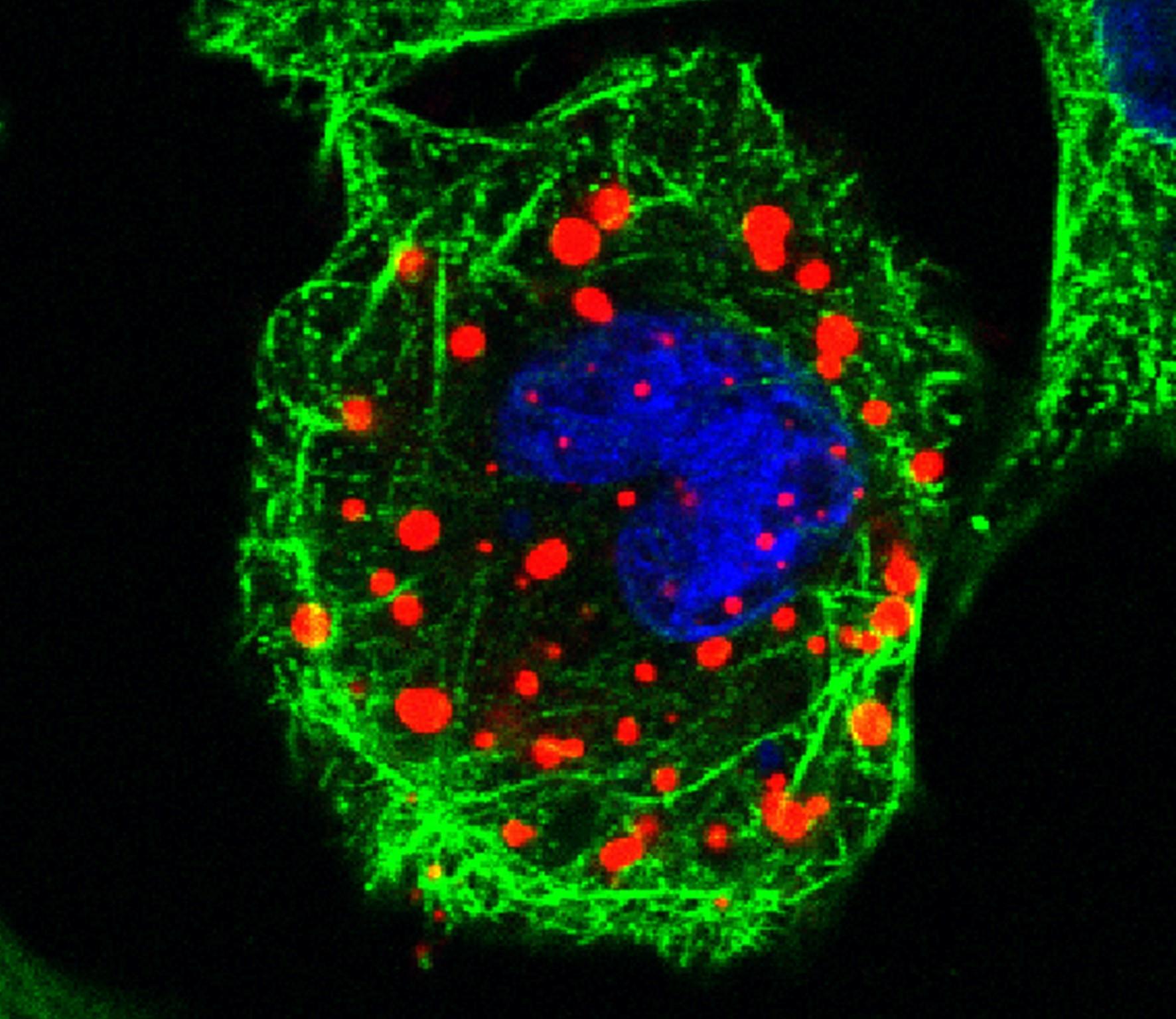 IBDV infected cell (red), tubulin (green) and the nucleus (blue)