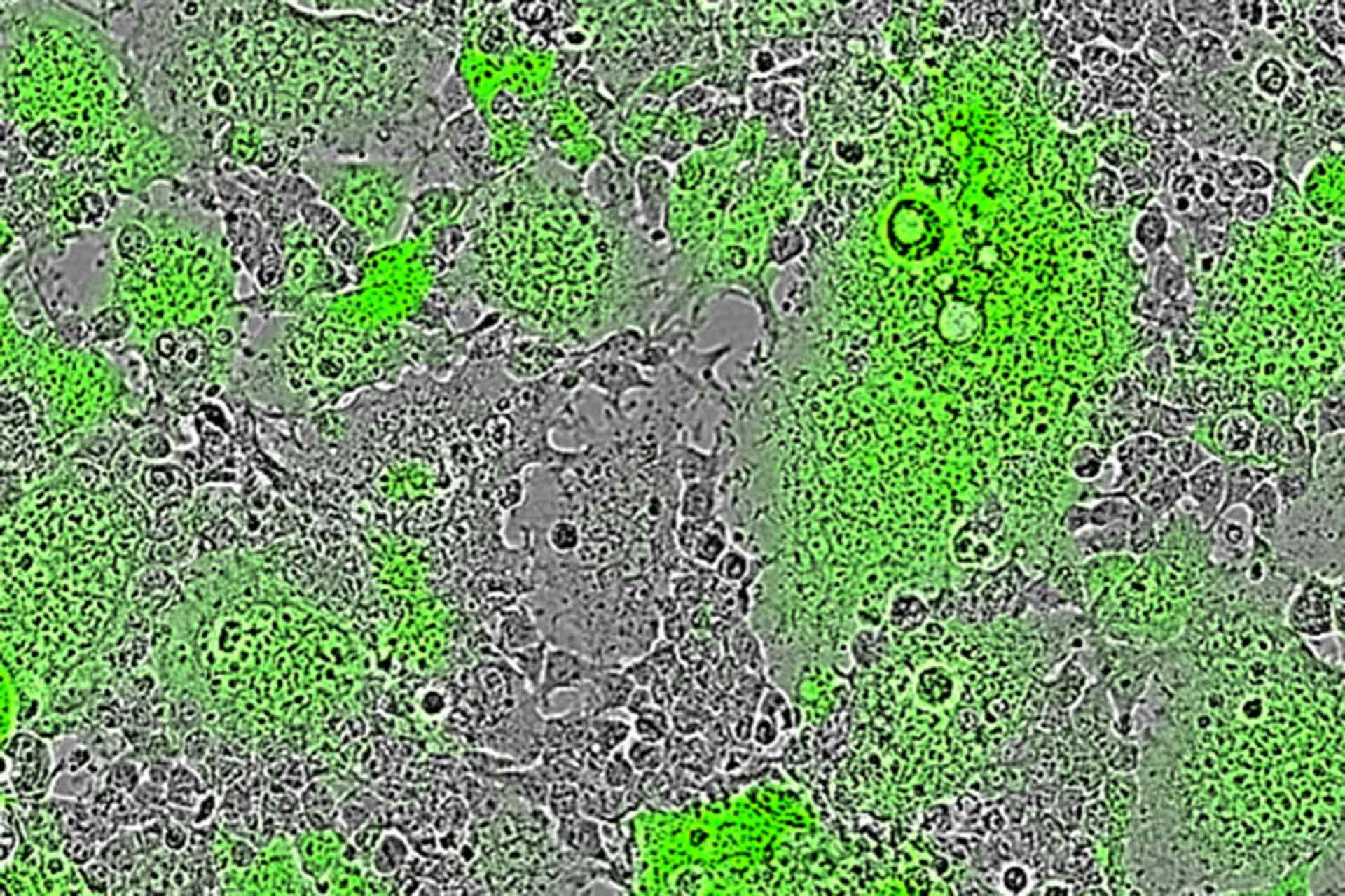 Nipah virus induced cell-cell fusion leads to the formation of fluorescent syncytia shown in green (multi-nucleated cells) in Pirbright’s mFIT assay