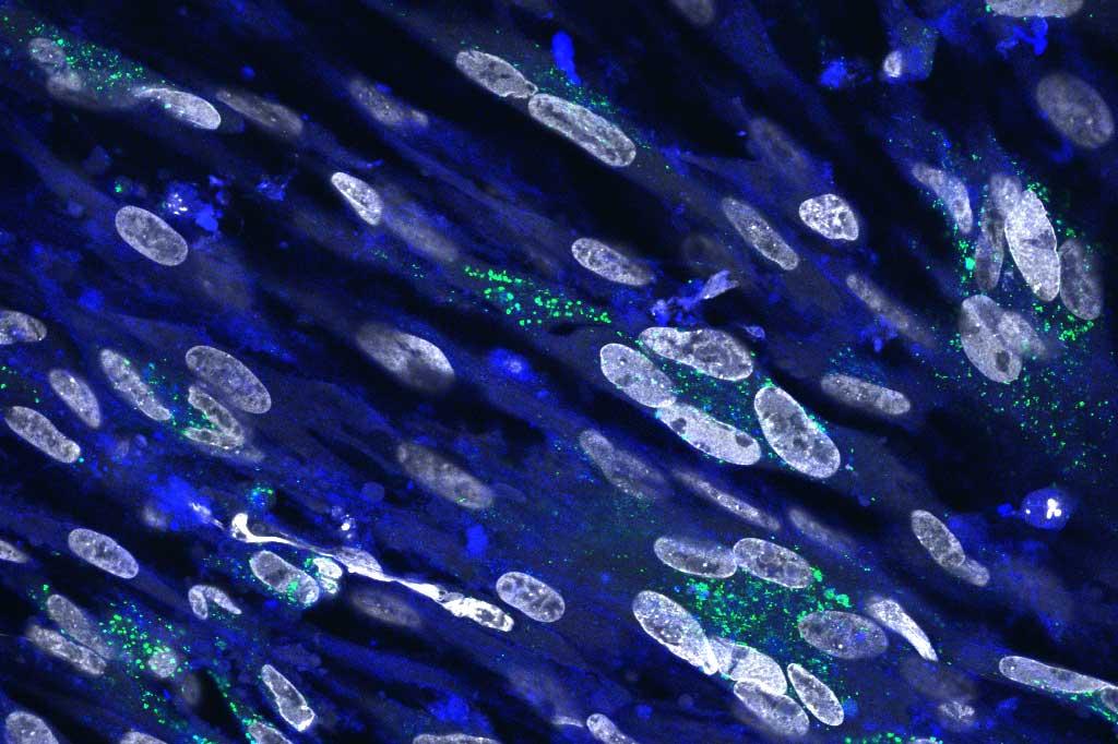 Cholesterol (blue) and MDV glycoprotein B (green) in infected cells in the presence of a cholesterol inhibitor. Nuclei shown in white.