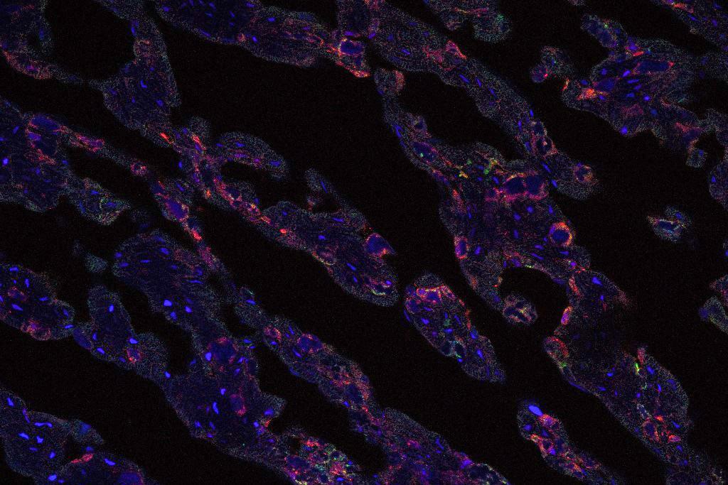 Image shows dog heart tissue infected with foot-and-mouth disease virus (FMDV). Green and red show FMDV proteins, blue shows cell nuclei.