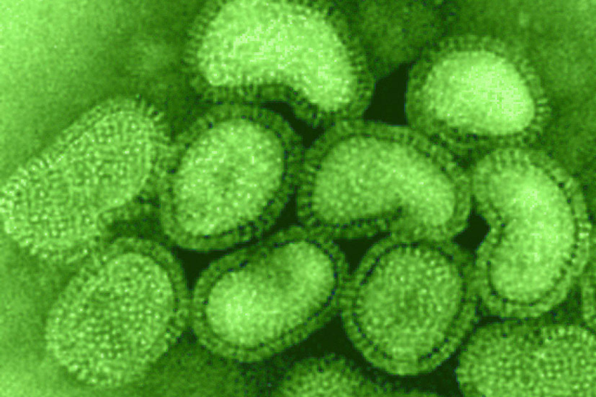 Green image showing influenza infected cells