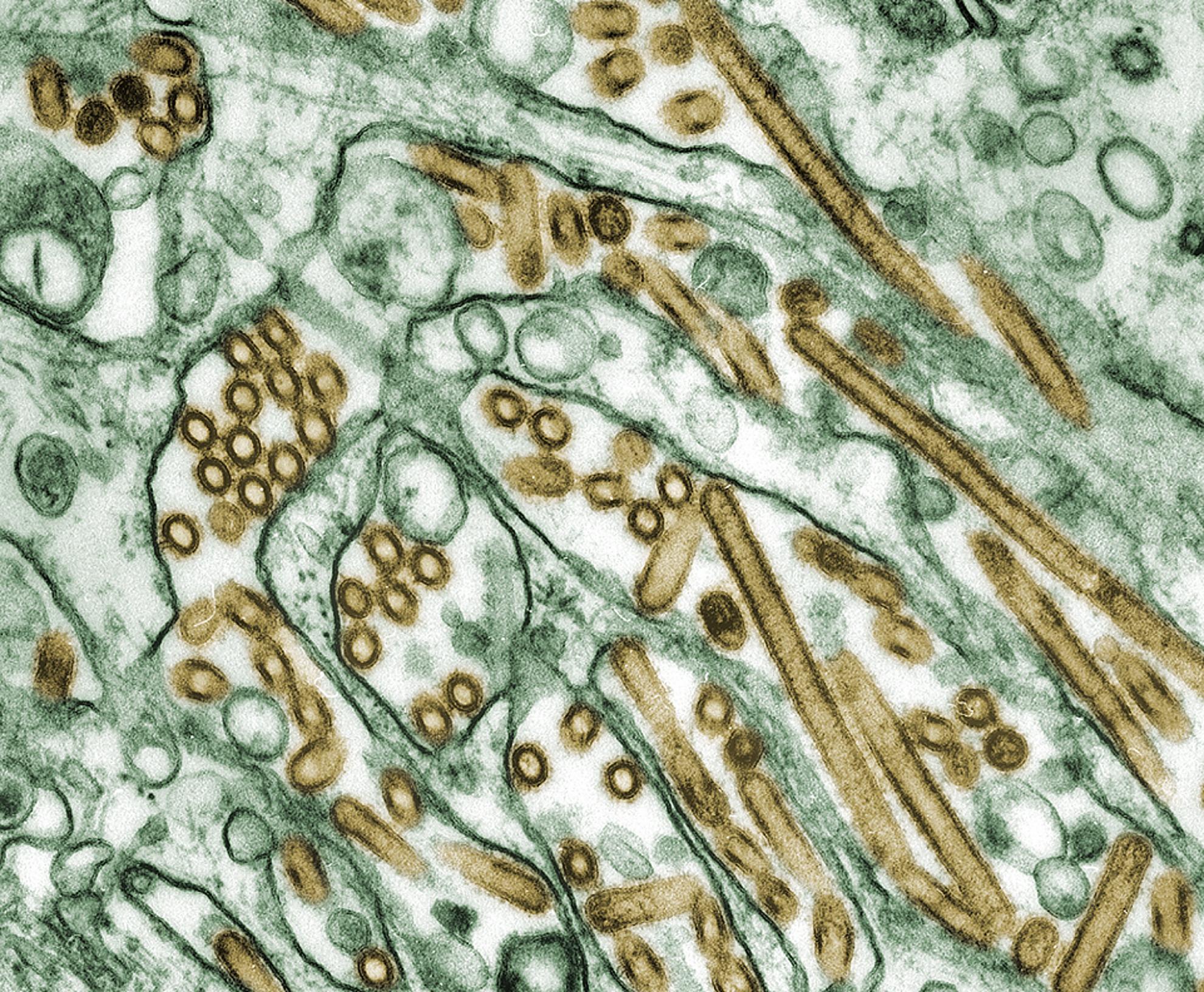 Influenza filamentous and globular (shown in brown)