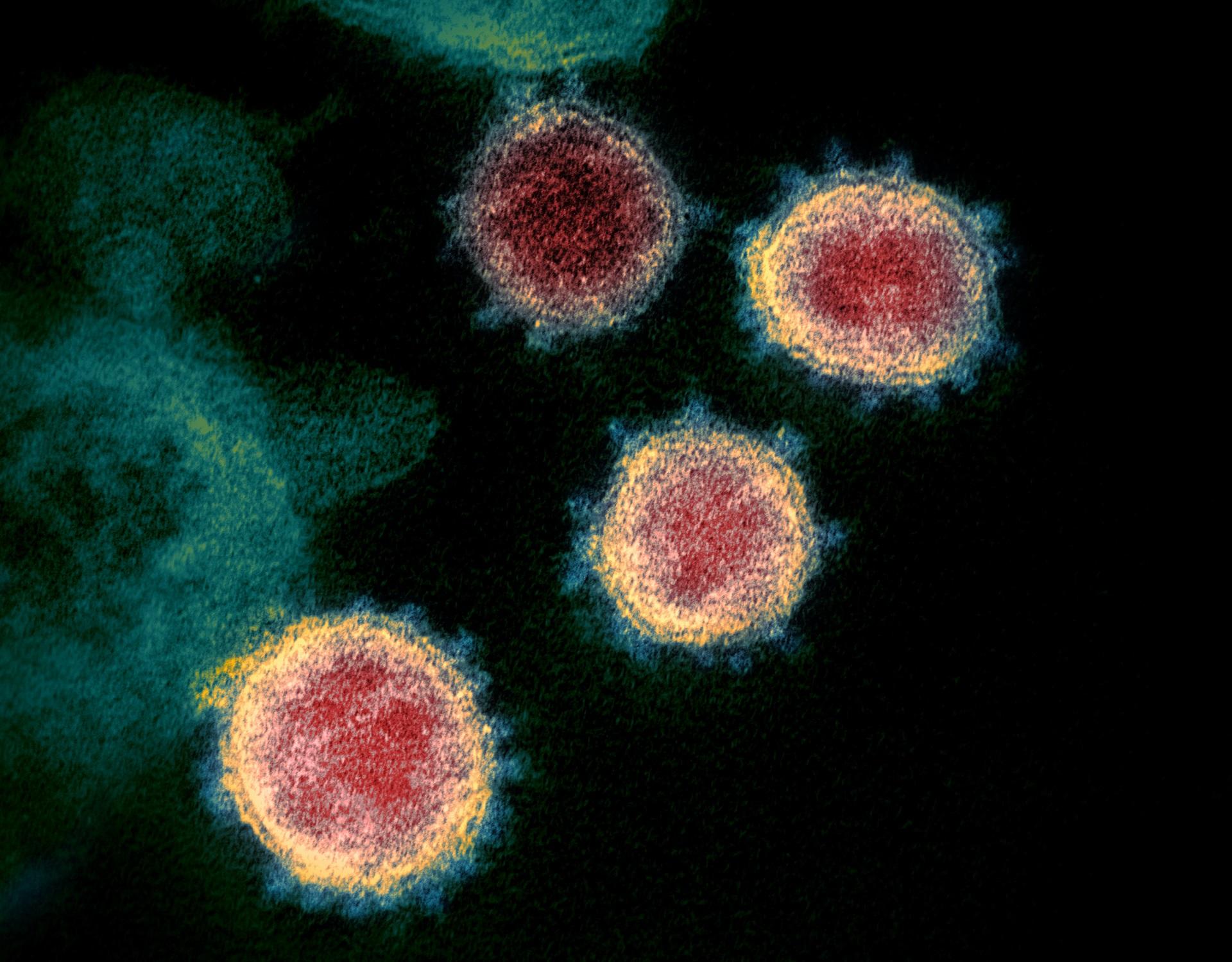 Transmission electron microscope image shows SARS-CoV-2, the virus that causes COVID-19. Crown-like spikes on the outer edge of the virus particles give coronaviruses their name.