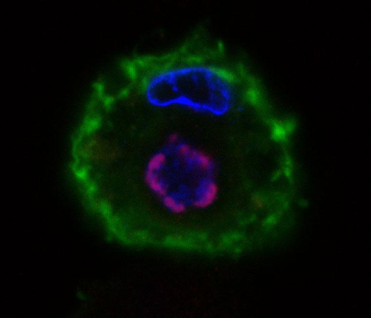 A macrophage infected with ASFV