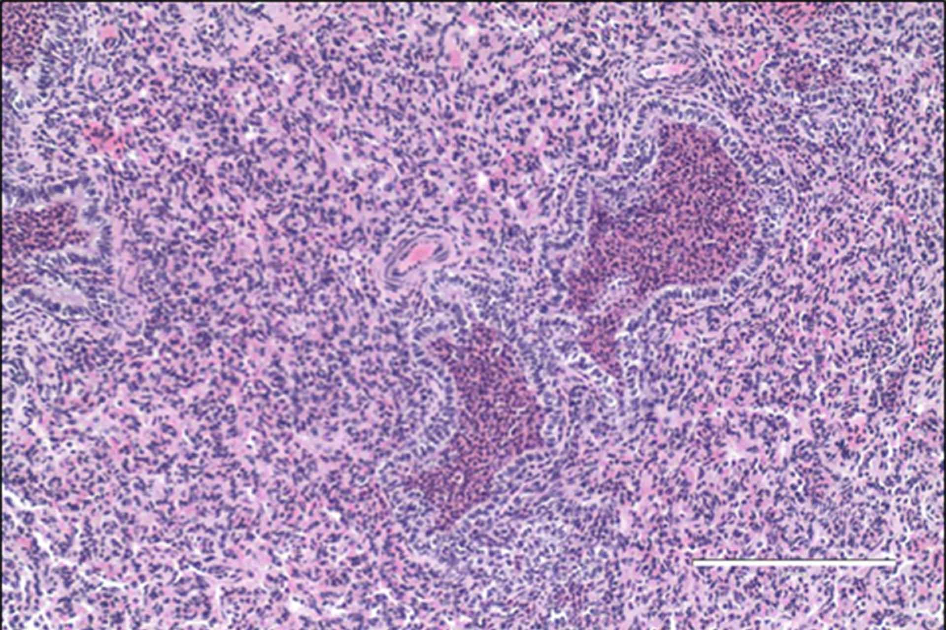 BRSV infected calf lung