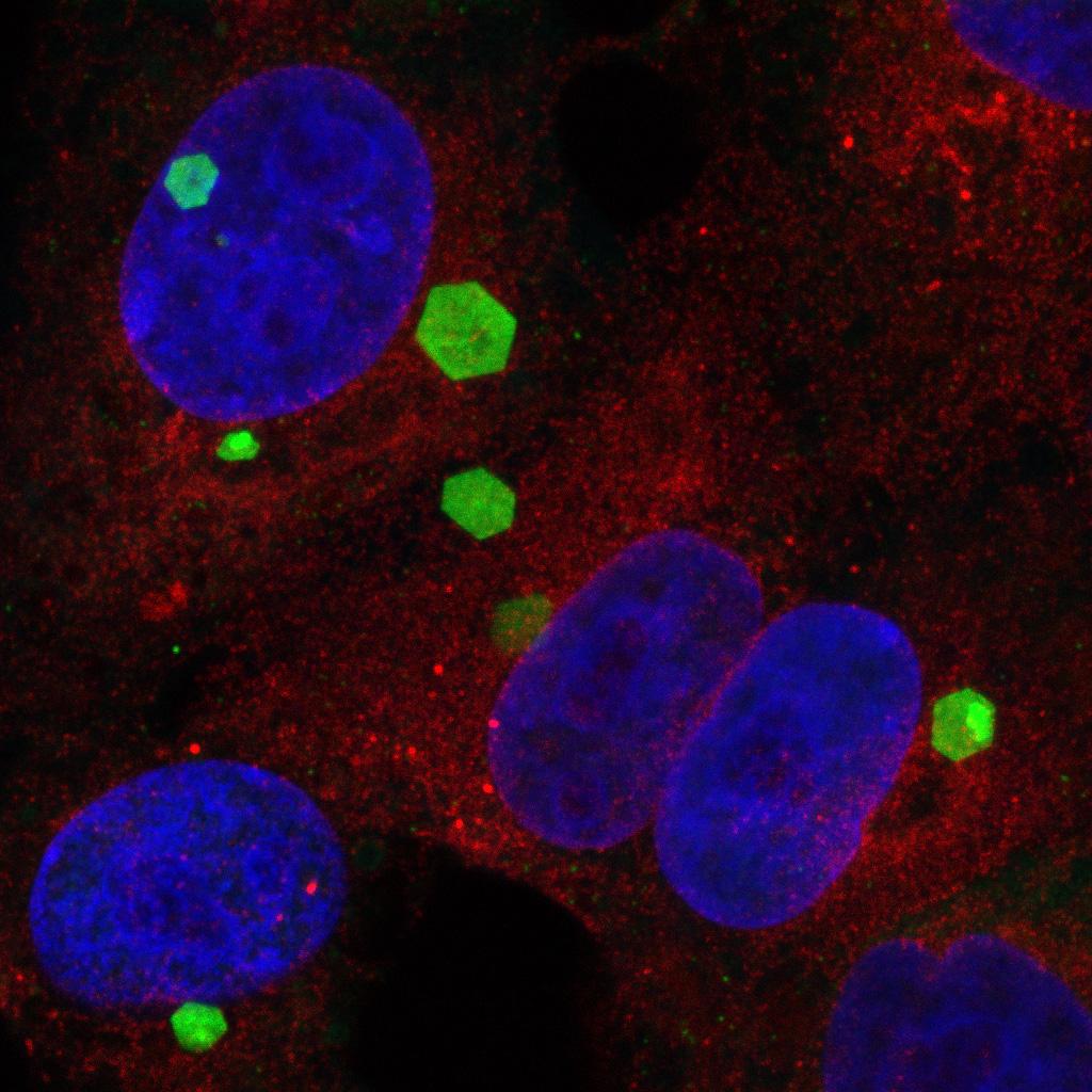 Fluorescent bioimaging image of AHSV